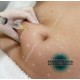 CURSO DE MESOTERAPIA