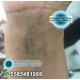 Picosecond Picolaser YAG portátil para eliminación de manchas o tatuajes