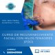 CURSO DE REJUVENECIMIENTO FACIAL CON HILOS TENSORES (PDO)
